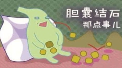 什么是膽囊結(jié)石？